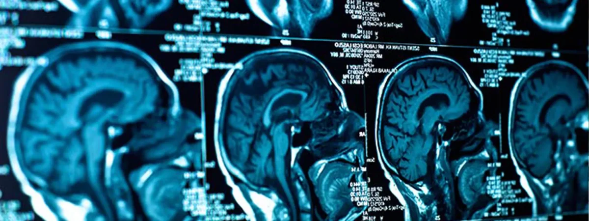Abogado de Lesiones Cerebrales en Denver